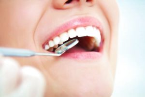 Dentista Vergaro Bologna: estetica dentale