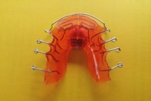 Dentista Vergaro Bologna: ortodonzia